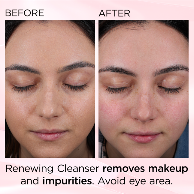 Before and after — Renewing Cleanser removes makeup and impurities