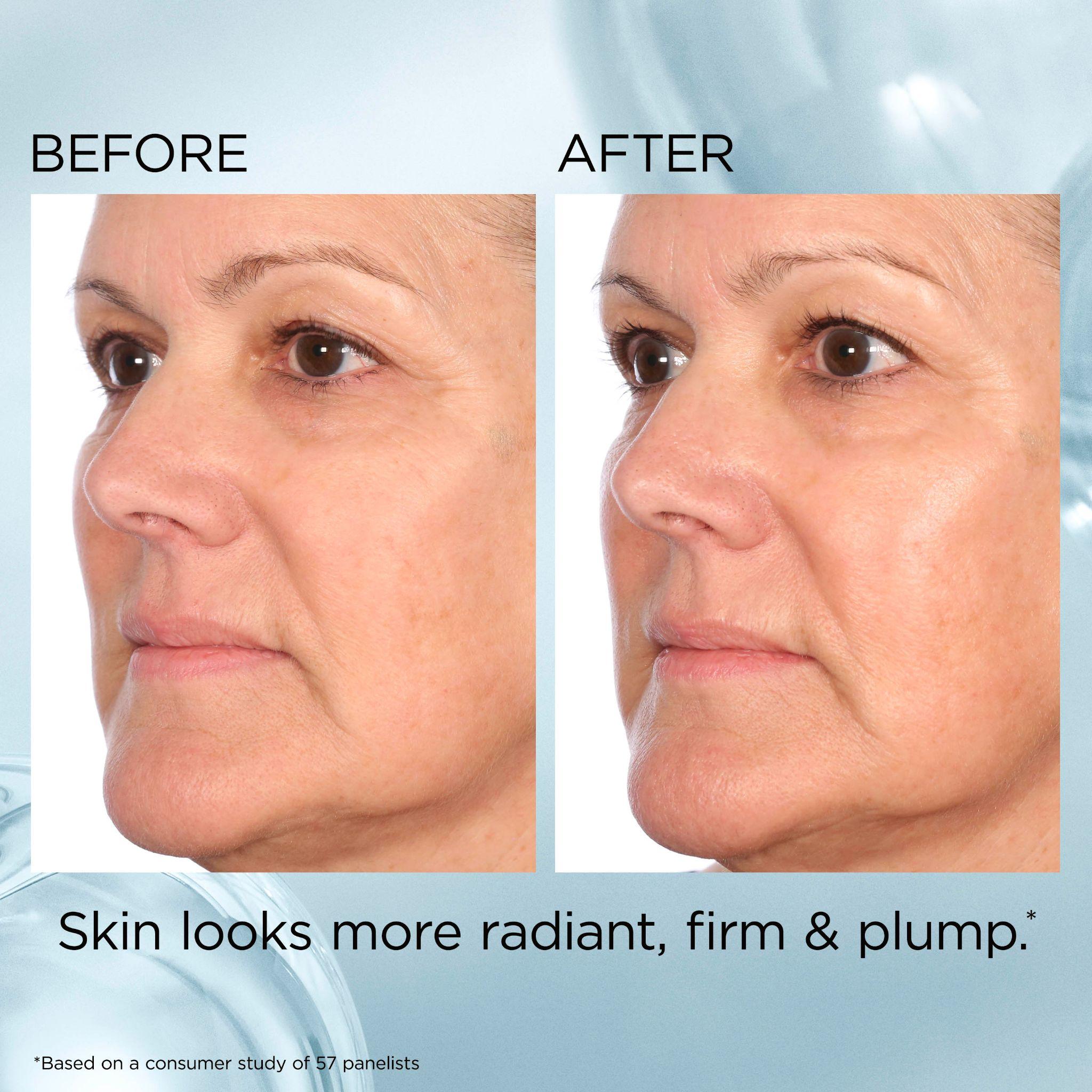 Before and after — visibly plumper, firmer, glowing skin